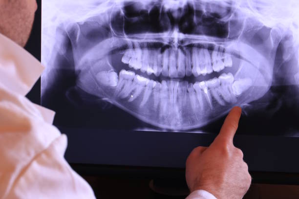 Best Emergency Dentist for Knocked-Out Tooth in Interlaken, CA