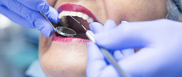Best Holiday Emergency Dentist in Interlaken, CA